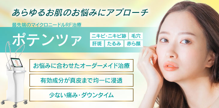 ポテンツァ導入