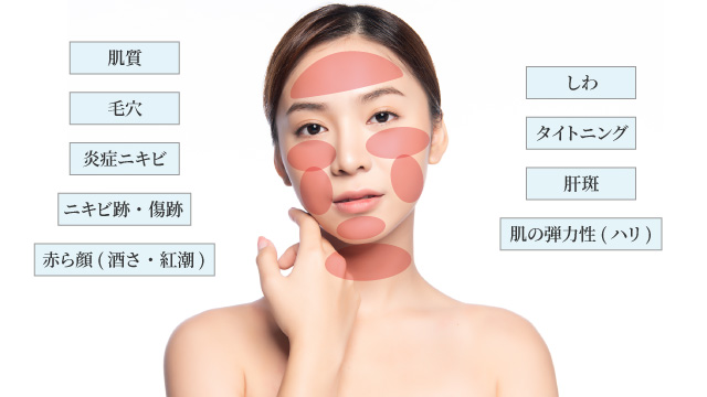 適応症例