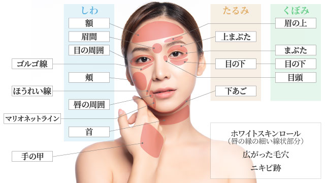 施術部位