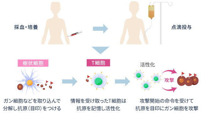 CAT療法とは