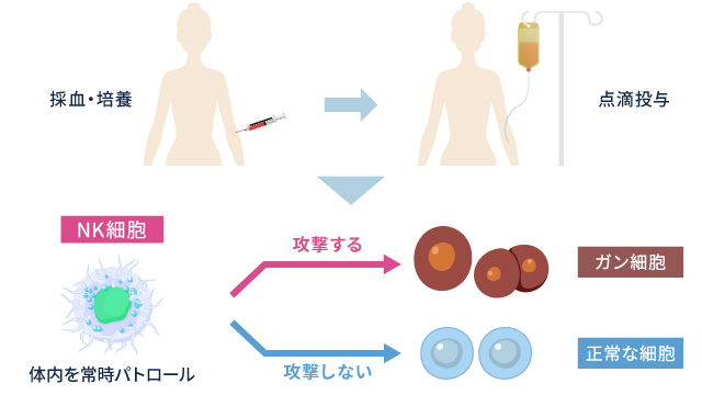 NK細胞療法とは